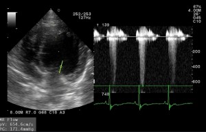 080601_20150924_VET--HEART-__0004 (640x412)